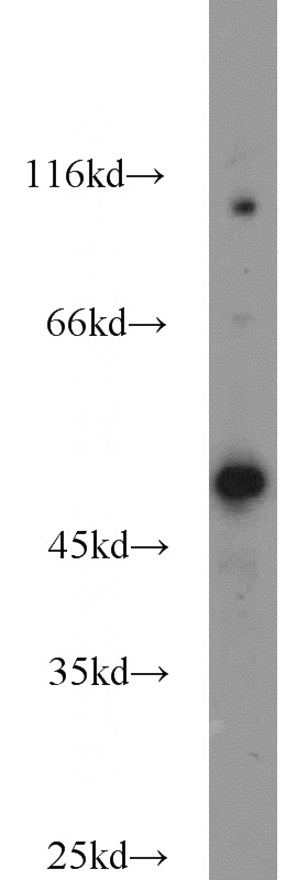 Jurkat cells were subjected to SDS PAGE followed by western blot with Catalog No:117093(B3GNT7 antibody) at dilution of 1:1000