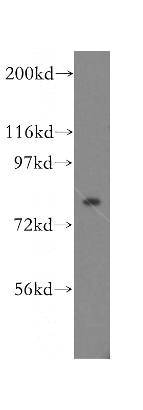 human cerebellum tissue were subjected to SDS PAGE followed by western blot with Catalog No:112013(KIF3A antibody) at dilution of 1:500