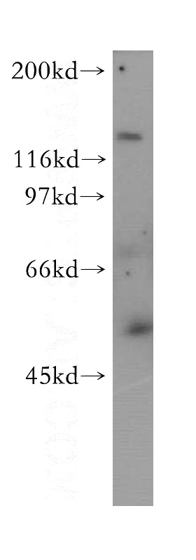 PC-3 cells were subjected to SDS PAGE followed by western blot with Catalog No:114498(RABGEF1 antibody) at dilution of 1:300