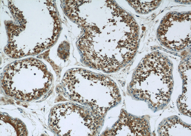 Immunohistochemistry of paraffin-embedded human testis tissue slide using Catalog No:114747(RNF17 Antibody) at dilution of 1:50 (under 10x lens)