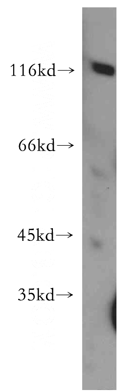 human brain tissue were subjected to SDS PAGE followed by western blot with Catalog No:113665(PDE6A antibody) at dilution of 1:500