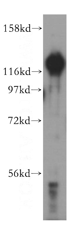 HepG2 cells were subjected to SDS PAGE followed by western blot with Catalog No:111465(HDGF2 antibody) at dilution of 1:500