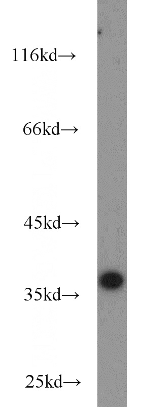 K-562 cells were subjected to SDS PAGE followed by western blot with Catalog No:107668(A4GNT antibody) at dilution of 1:1000