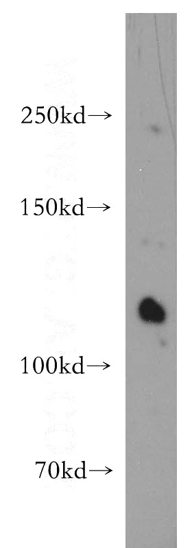 HEK-293 cells were subjected to SDS PAGE followed by western blot with Catalog No:115682(STARD8 antibody) at dilution of 1:400