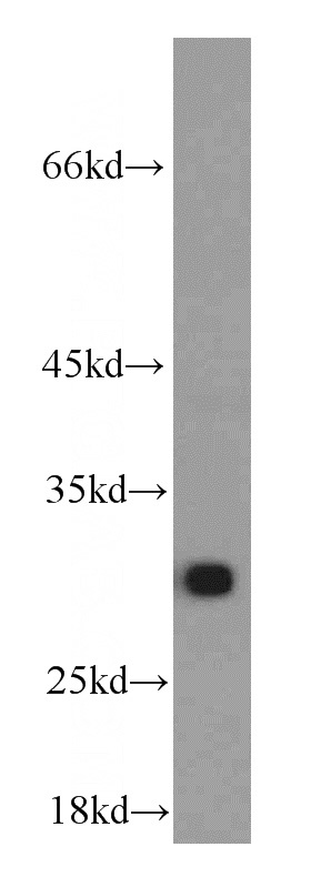 HeLa cells were subjected to SDS PAGE followed by western blot with Catalog No:107565(AK2 antibody) at dilution of 1:4000