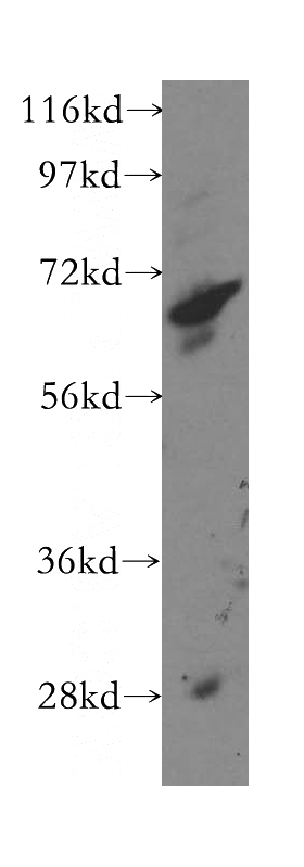 MCF7 cells were subjected to SDS PAGE followed by western blot with Catalog No:107717(ACAD9 antibody) at dilution of 1:500