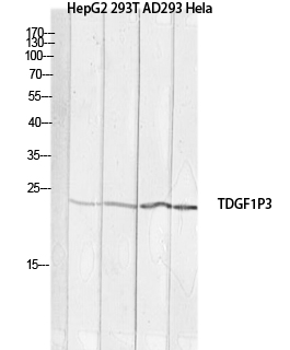 Fig1:; Western blot analysis of HepG2 293T AD293 Hela lysis using TDGF1P3 antibody. Antibody was diluted at 1:1000. Secondary antibody（catalog#: HA1001) was diluted at 1:20000