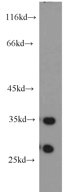 mouse skin tissue were subjected to SDS PAGE followed by western blot with Catalog No:108903(CAPNS2 antibody) at dilution of 1:300