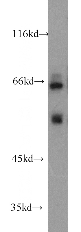 Jurkat cells were subjected to SDS PAGE followed by western blot with Catalog No:112772(MTF2 antibody) at dilution of 1:600