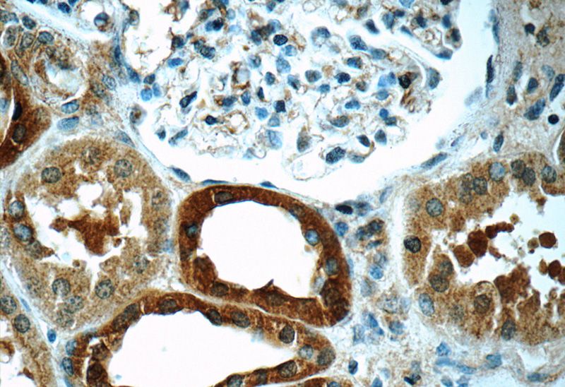 Immunohistochemistry of paraffin-embedded human kidney tissue slide using Catalog No:116424(TSC22D2 Antibody) at dilution of 1:50 (under 40x lens)