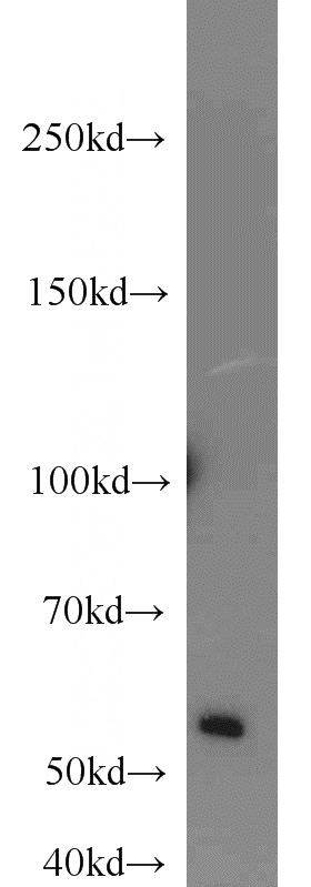 Jurkat cells were subjected to SDS PAGE followed by western blot with Catalog No:115436(SMARCE1 antibody) at dilution of 1:1000