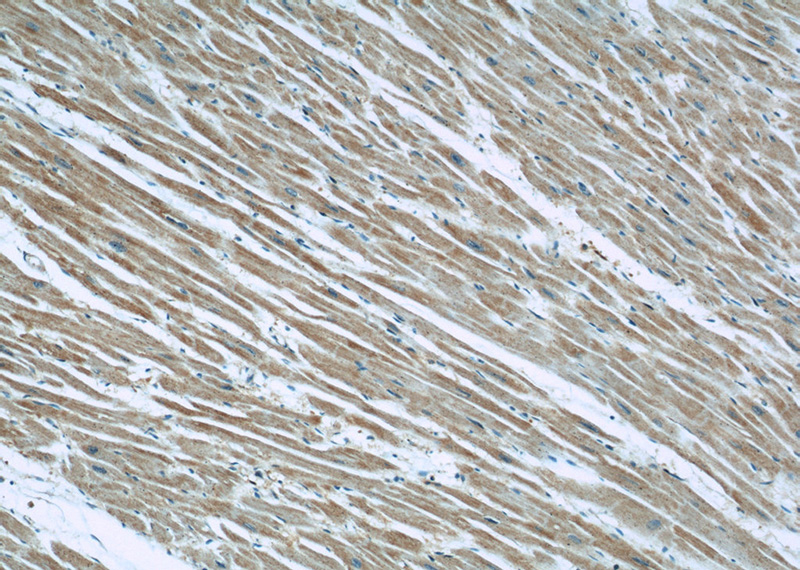 Immunohistochemical of paraffin-embedded human heart using Catalog No:110206(EFEMP2 antibody) at dilution of 1:50 (under 10x lens)