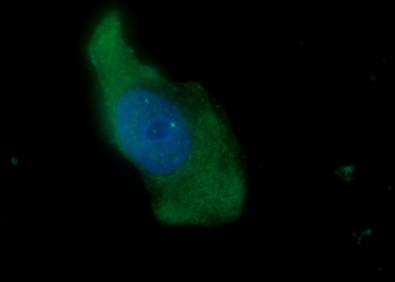 Immunofluorescent analysis of A431 cells using Catalog No:113199(NKIRAS2 Antibody) at dilution of 1:50 and Alexa Fluor 488-congugated AffiniPure Goat Anti-Rabbit IgG(H+L)