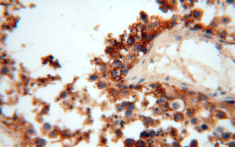 Immunohistochemical of paraffin-embedded human testis using Catalog No:110364(ERLIN1 antibody) at dilution of 1:100 (under 40x lens)