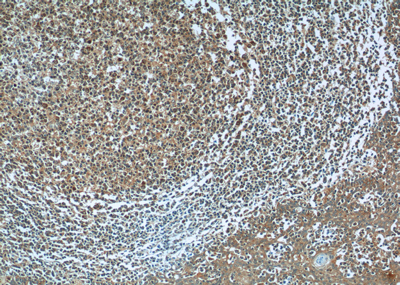 Immunohistochemistry of paraffin-embedded human tonsillitis tissue slide using Catalog No:113792(PGP Antibody) at dilution of 1:50 (under 10x lens)