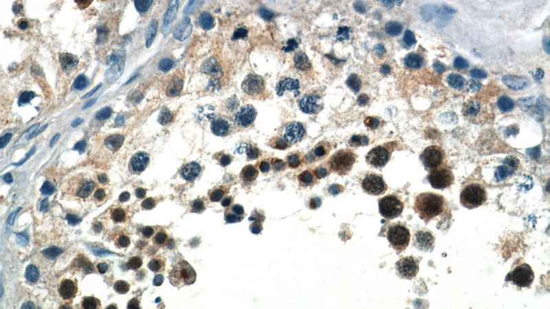 Immunohistochemistry of paraffin-embedded human testis slide using Catalog No:115048(SALL4 Antibody) at dilution of 1:50