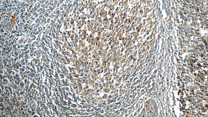 Immunohistochemistry of paraffin-embedded human tonsillitis tissue slide using Catalog No:112320(LRMP Antibody) at dilution of 1:50 (under 10x lens)