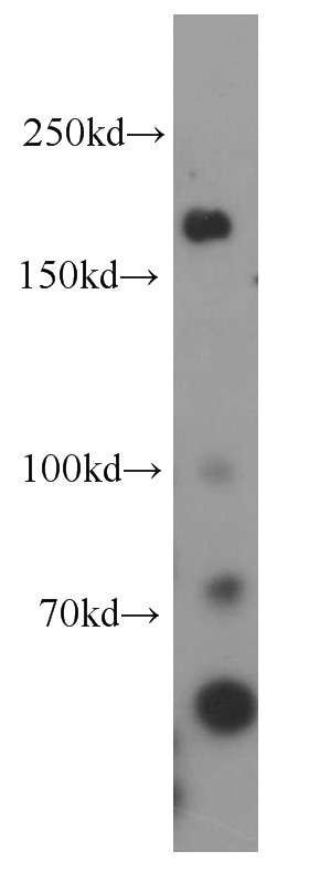 K-562 cells were subjected to SDS PAGE followed by western blot with Catalog No:112476(MAP3K4 antibody) at dilution of 1:2000