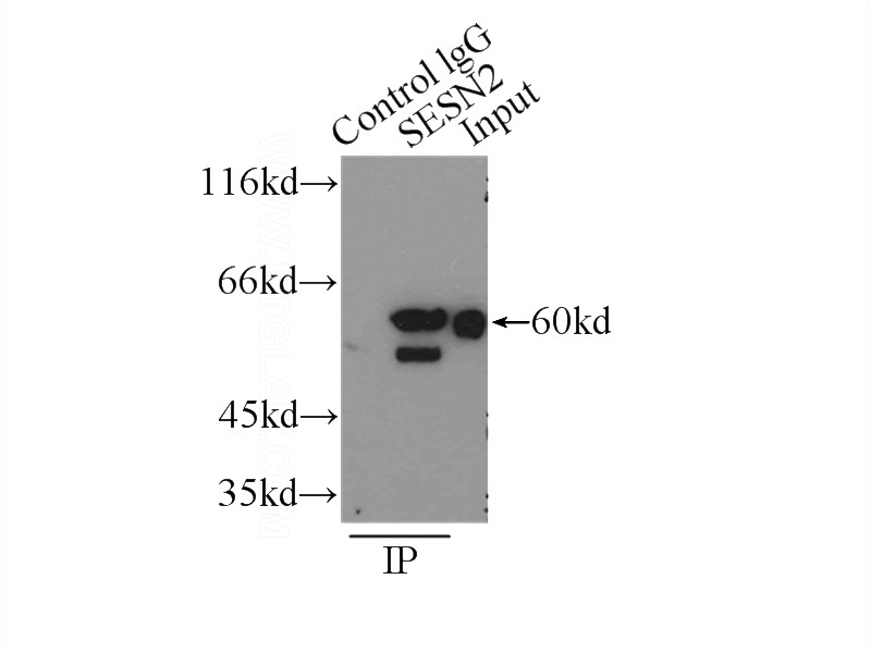 IP Result of anti-Sestrin2 (IP:Catalog No:115218, 3ug; Detection:Catalog No:115218 1:1000) with K-562 cells lysate 4000ug.