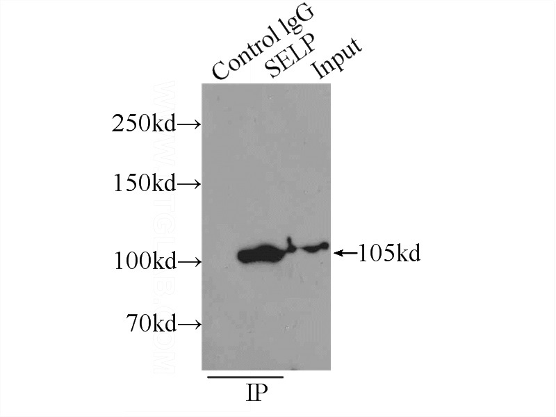 IP Result of anti-SELP (IP:Catalog No:107488, 5ug; Detection:Catalog No:107488 1:600) with K-562 cells lysate 1760ug.
