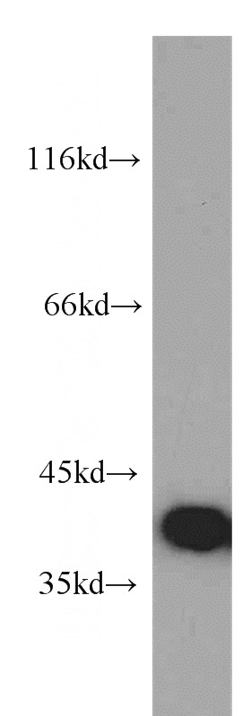 human brain tissue were subjected to SDS PAGE followed by western blot with Catalog No:109357(CNPY3 antibody) at dilution of 1:500