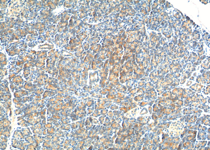 Immunohistochemistry of paraffin-embedded human pancreas tissue slide using Catalog No:116892(YRDC Antibody) at dilution of 1:200 (under 10x lens).