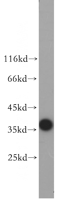 human brain tissue were subjected to SDS PAGE followed by western blot with Catalog No:116173(TOMM40 antibody) at dilution of 1:600