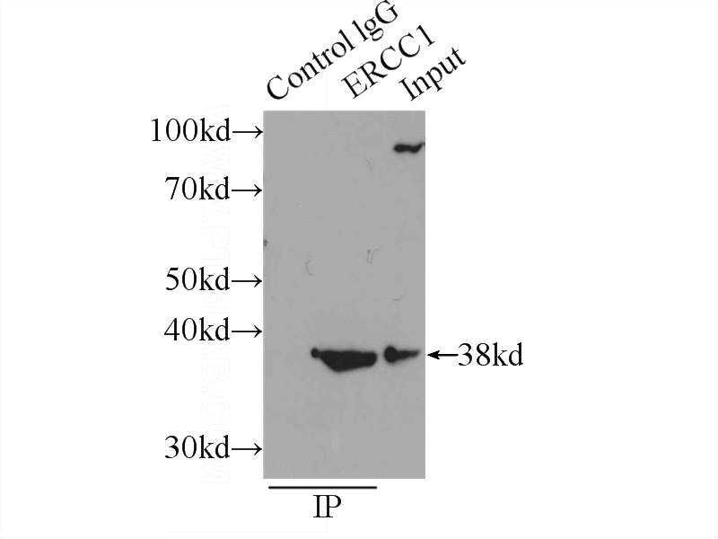 IP Result of anti-ERCC1 (IP:Catalog No:110407, 3ug; Detection:Catalog No:110407 1:300) with MCF-7 cells lysate 1600ug.