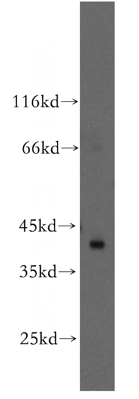 HeLa cells were subjected to SDS PAGE followed by western blot with Catalog No:114518(RAD51L1 antibody) at dilution of 1:600