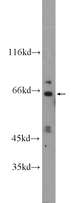Jurkat cells were subjected to SDS PAGE followed by western blot with Catalog No:112100(KLHL28 Antibody) at dilution of 1:300