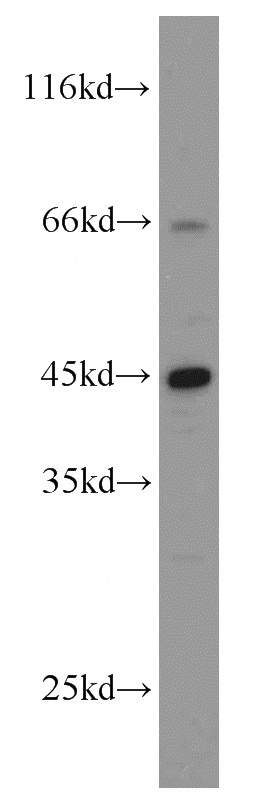Y79 cells were subjected to SDS PAGE followed by western blot with Catalog No:113266(NR2E3 antibody) at dilution of 1:1000