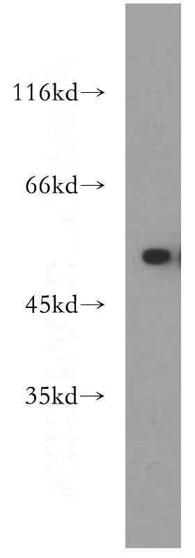 mouse heart tissue were subjected to SDS PAGE followed by western blot with Catalog No:110114(DUSP10 antibody) at dilution of 1:500