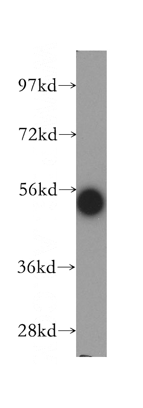 human brain tissue were subjected to SDS PAGE followed by western blot with Catalog No:115699(STAU1 antibody) at dilution of 1:300