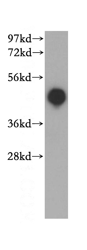 HepG2 cells were subjected to SDS PAGE followed by western blot with Catalog No:111414(HLA class I (HLA-A) antibody) at dilution of 1:500