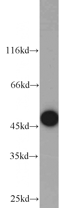 HEK-293 cells were subjected to SDS PAGE followed by western blot with Catalog No:115949(TES antibody) at dilution of 1:300