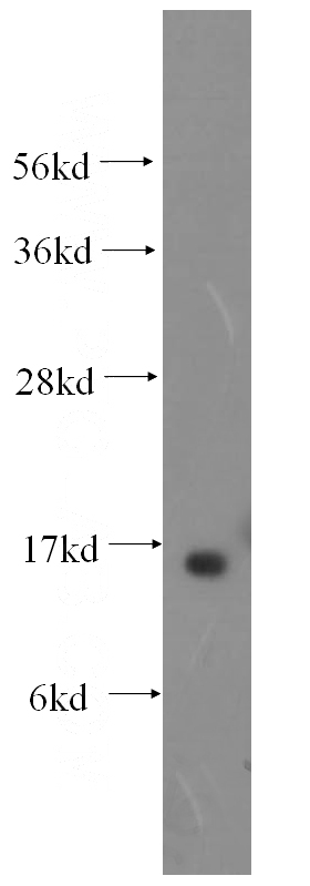 human liver tissue were subjected to SDS PAGE followed by western blot with Catalog No:114563(RBP5 antibody) at dilution of 1:400