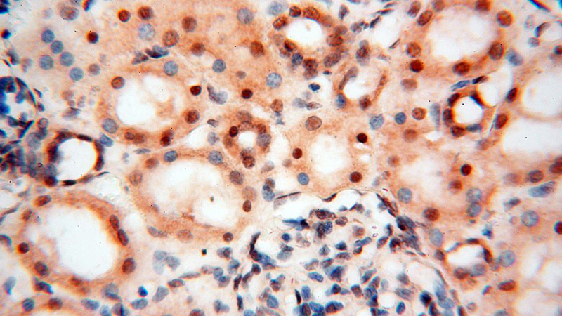 Immunohistochemical of paraffin-embedded human kidney using Catalog No:110257(EIF4A3 antibody) at dilution of 1:100 (under 40x lens)