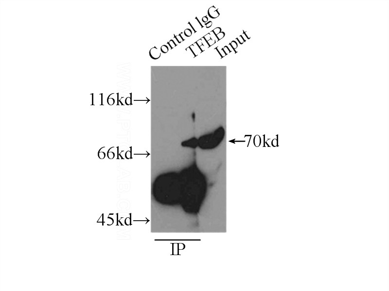 IP Result of anti-TFEB (IP:Catalog No:116009, 3ug; Detection:Catalog No:116009 1:1000) with NIH/3T3 cells lysate 3300ug.