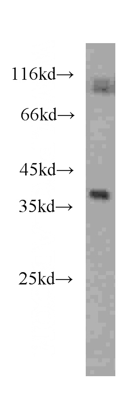 human heart tissue were subjected to SDS PAGE followed by western blot with Catalog No:107505(RENALASE antibody) at dilution of 1:2000