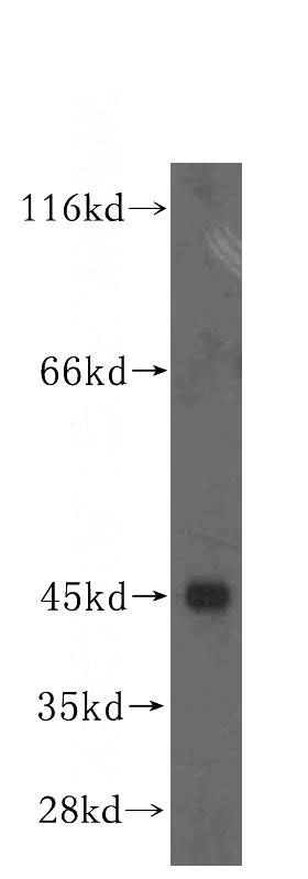 HeLa cells were subjected to SDS PAGE followed by western blot with Catalog No:112856(MRPS31 antibody) at dilution of 1:500