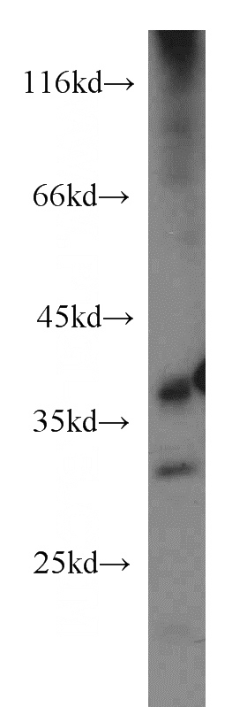 HeLa cells were subjected to SDS PAGE followed by western blot with Catalog No:112822(MRPL3 antibody) at dilution of 1:1000