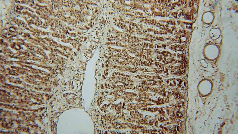 Immunohistochemical of paraffin-embedded human adrenal gland using Catalog No:107970(ALDH3B2 antibody) at dilution of 1:50 (under 10x lens)