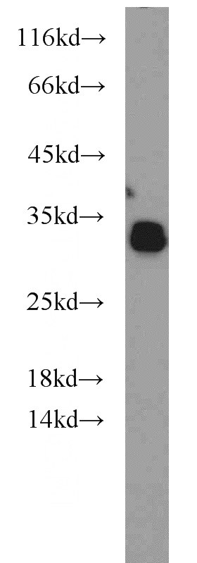 human brain tissue were subjected to SDS PAGE followed by western blot with Catalog No:113206(NPAS3 antibody) at dilution of 1:600