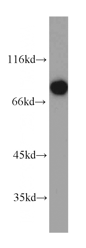 HeLa cells were subjected to SDS PAGE followed by western blot with Catalog No:112040(KHSRP antibody) at dilution of 1:500