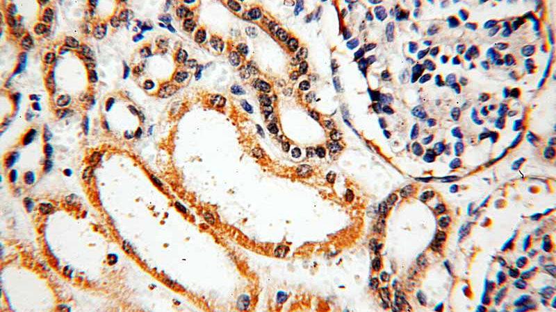 Immunohistochemical of paraffin-embedded human kidney using Catalog No:112101(KLHL29 antibody) at dilution of 1:100 (under 40x lens)