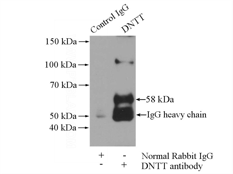 IP Result of anti-DNTT,TDT (IP:Catalog No:109972, 4ug; Detection:Catalog No:109972 1:300) with Raji cells lysate 2000ug.
