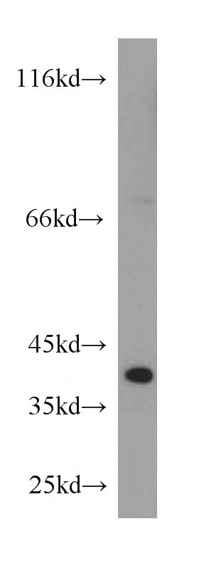 mouse kidney tissue were subjected to SDS PAGE followed by western blot with Catalog No:108295(ATG3 antibody) at dilution of 1:300