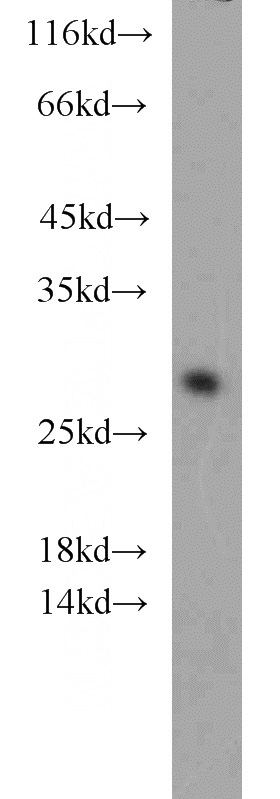 HeLa cells were subjected to SDS PAGE followed by western blot with Catalog No:109358(CNPY4 antibody) at dilution of 1:1000