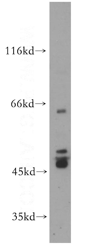 HL-60 cells were subjected to SDS PAGE followed by western blot with Catalog No:114322(PTPN5 antibody) at dilution of 1:100