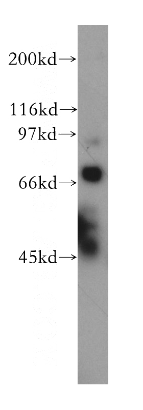 HEK-293 cells were subjected to SDS PAGE followed by western blot with Catalog No:115928(TDRD3 antibody) at dilution of 1:300